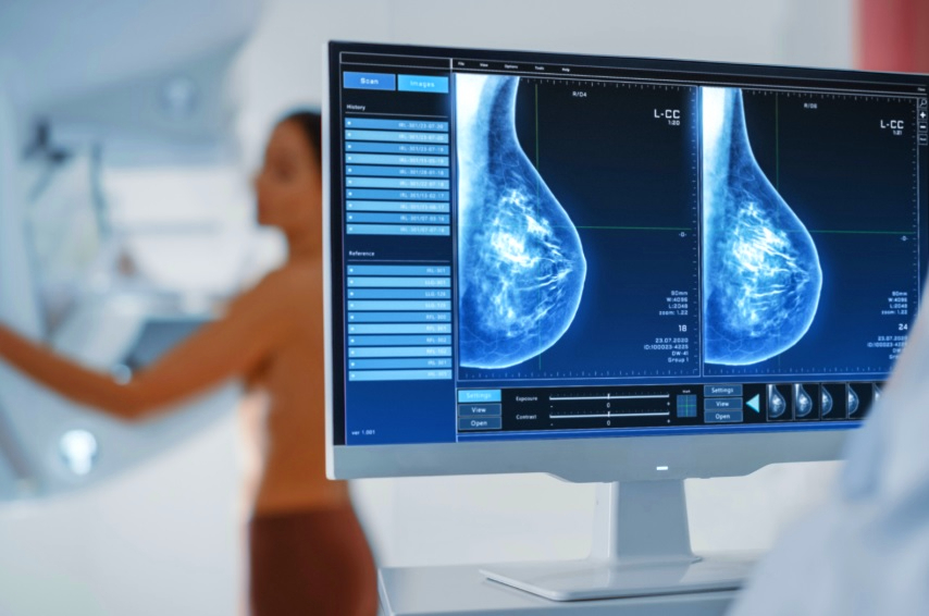 Pacientes do SUS têm até cinco vezes menos acesso a biópsias e mamografias em comparação com os da rede privada