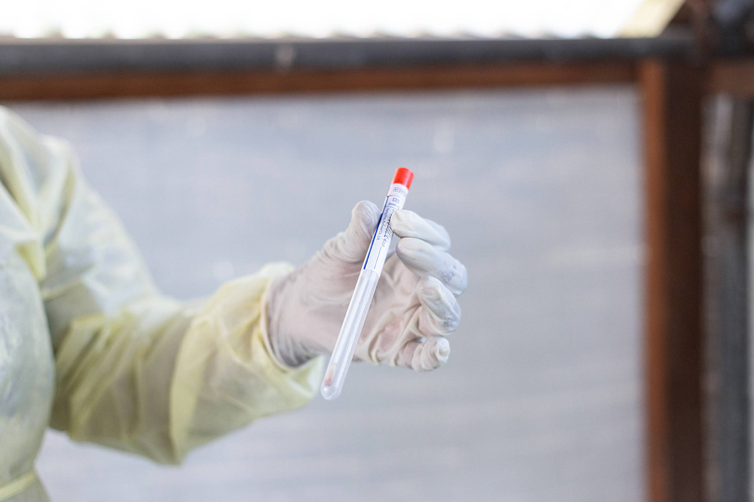 Cientista que desenvolveu vacina contra Covid é acusado de tentar contrabandear vírus de mpox