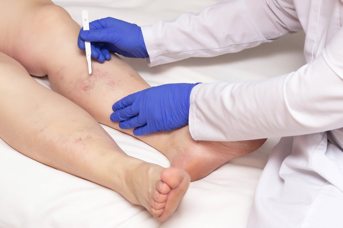 Cirurgião vascular: quem é, o que trata (e quando consultar)