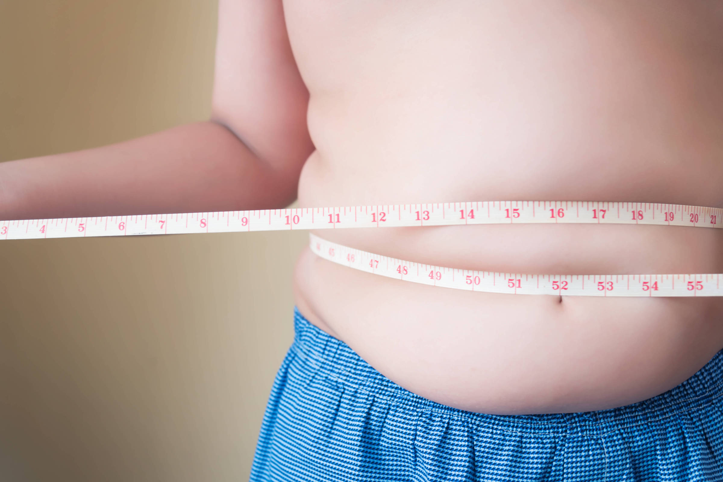 Obesidade custa até R$ 44,6 bilhões por ano aos cofres públicos do Brasil, diz estudo